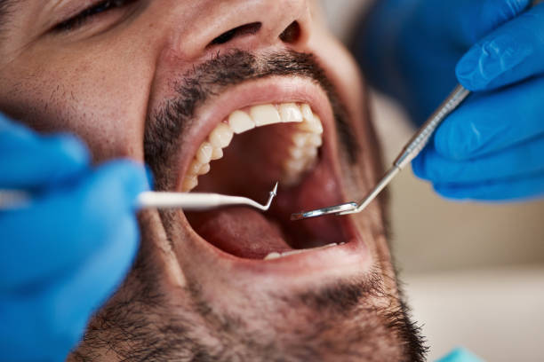 Best Cracked Tooth Emergency Dentist  in Roebuck, SC